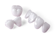 Dental Veneers Near Me Serving Santa Monica, Los Angeles, CA Dental Veneers Near Me Serving Santa Monica, Los Angeles, CA